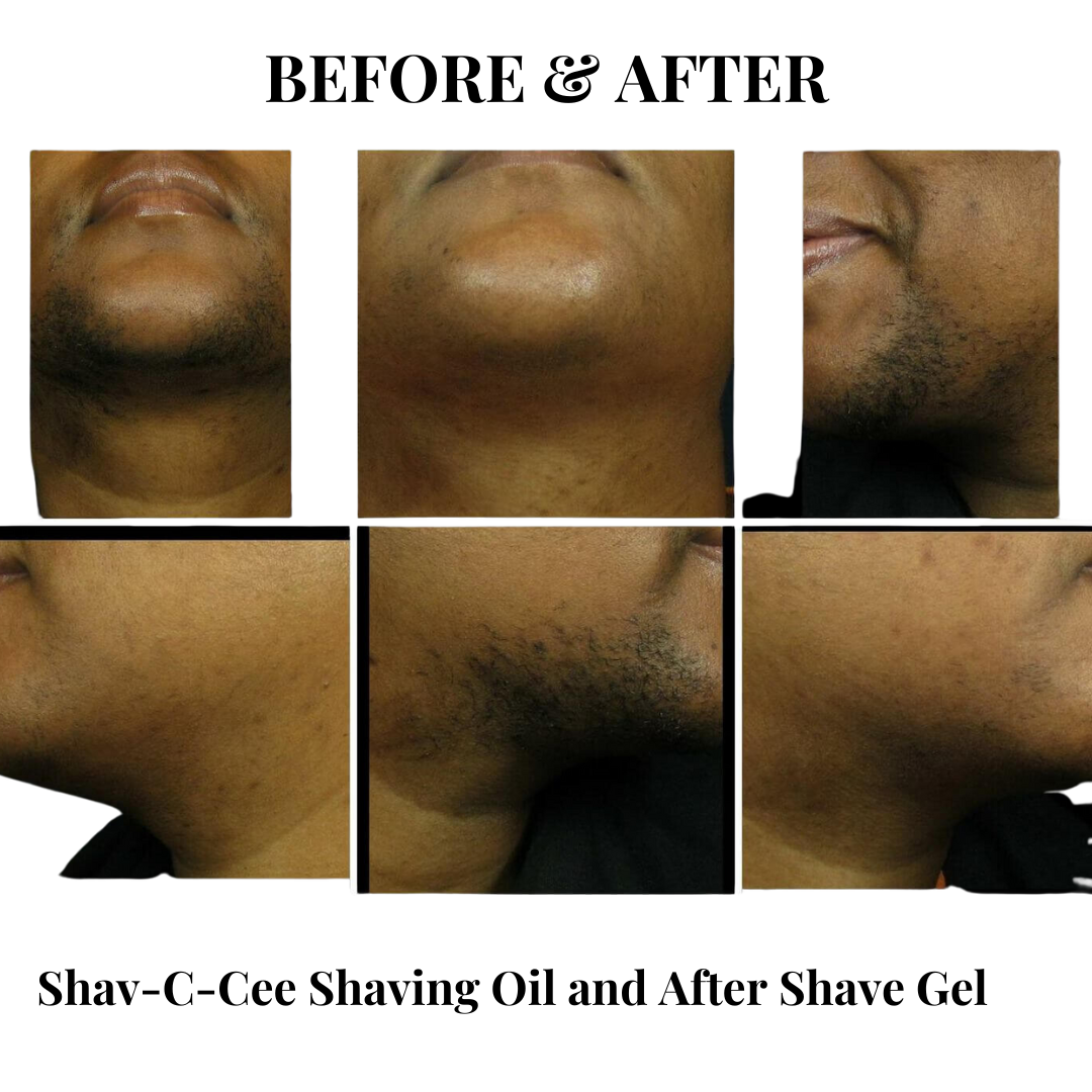 before and after pictures of results you can expect using the Shav-E-Cee line of products