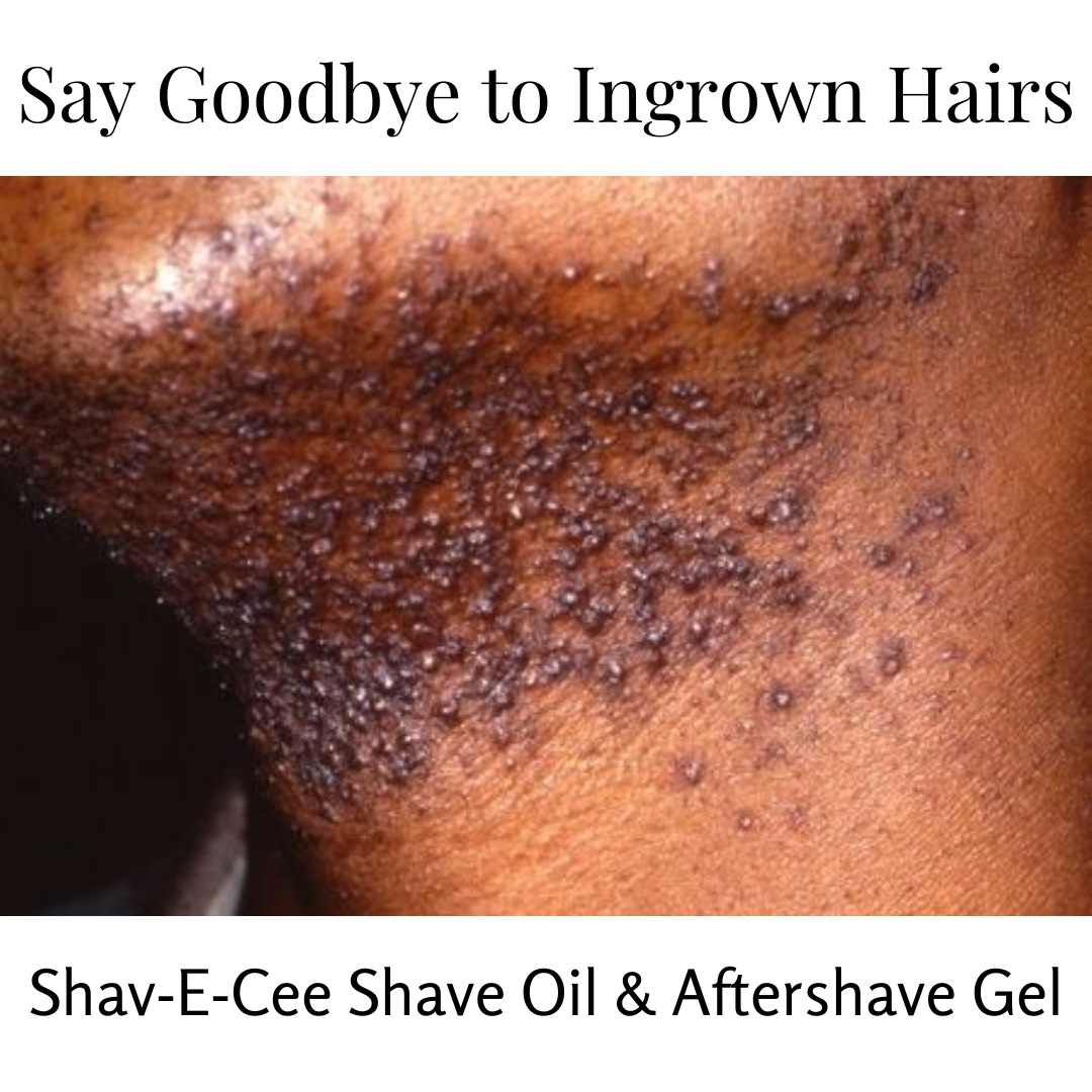 stop ingrown hair and razor bumps close pores to eliminate dead skin and remove hair from going back into pores